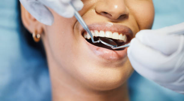 Best Emergency Wisdom Teeth Removal in Sudan, TX