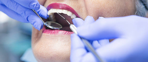 Best Emergency Treatment for Dental Infections or Abscesses in Sudan, TX